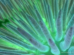 urchin1