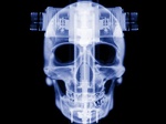  BB XRaySkull02