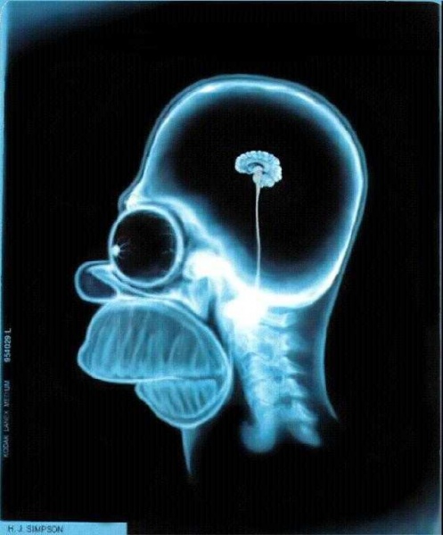 Simpsons__Homers_Brain.jpg